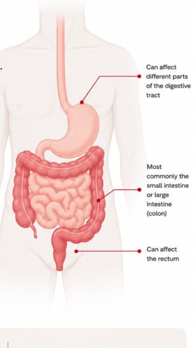 Illustration of the human digestive tract within a body outline