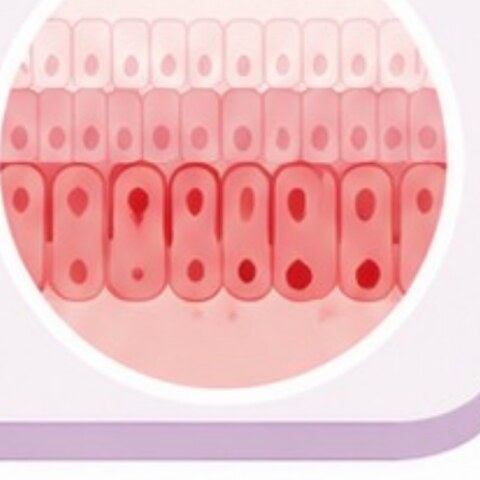 Illustration of inflamed cells in the bowel lining