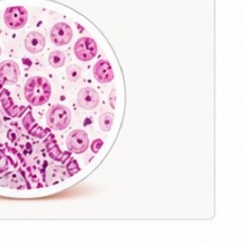 Microscopic illustration of bowel-lining cells
